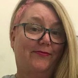 Amy from Minneapolis | Woman | 73 years old | Cancer